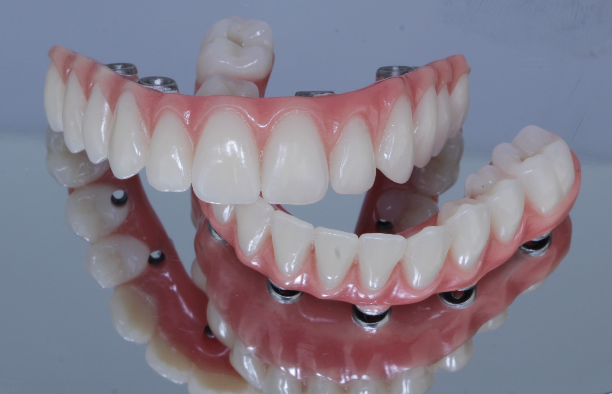 Dentes Fixos